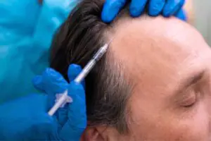 hair loss solution