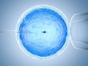 Low ovarian reserve