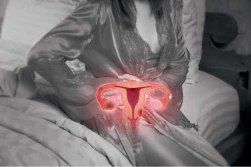 Endometriosis impact fertility