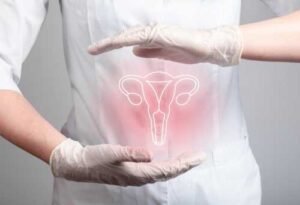 Impact of endometriosis on fertility 