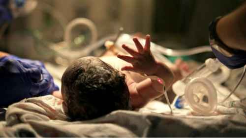 NICU care for newborns